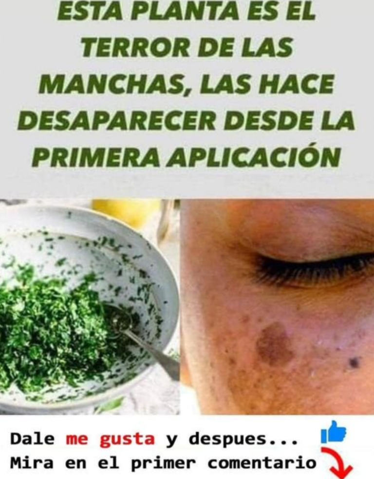 Mascarilla Casera De Perejil Para Las Arrugas Y Manchas Corte De Pelo